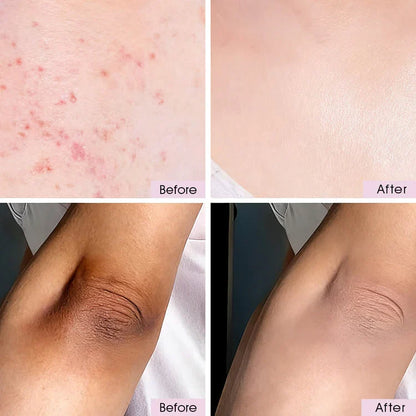 Kojic + Turmeric Body Peel Spray