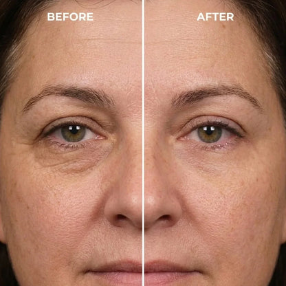Look More Refreshed in Just 10 Minutes
